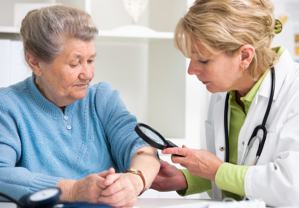 recognizing preventing melanoma seniors